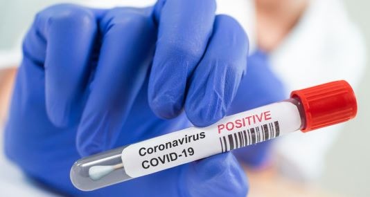 882 са новите случаи на коронавирус у нас Направени са